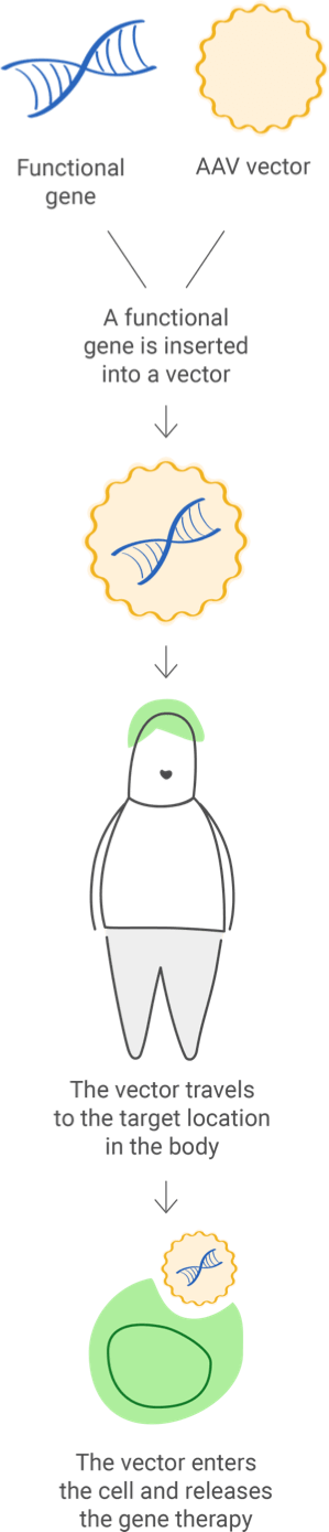 3 steps of adeno-associated virus (AAV) therapy shown in illustration. 1) Functional gene is inserted into vector. 2) Vector travels to target location in the body. 3) Vector enters target cell and releases gene therapy.